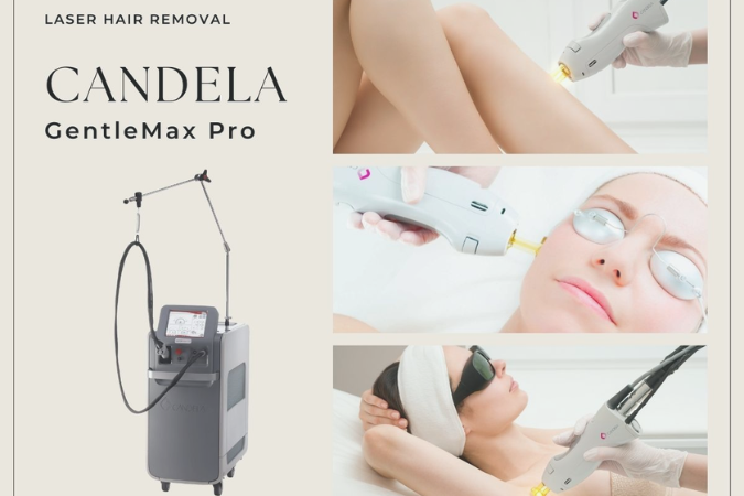 Features in Laser Hair Removal Machine