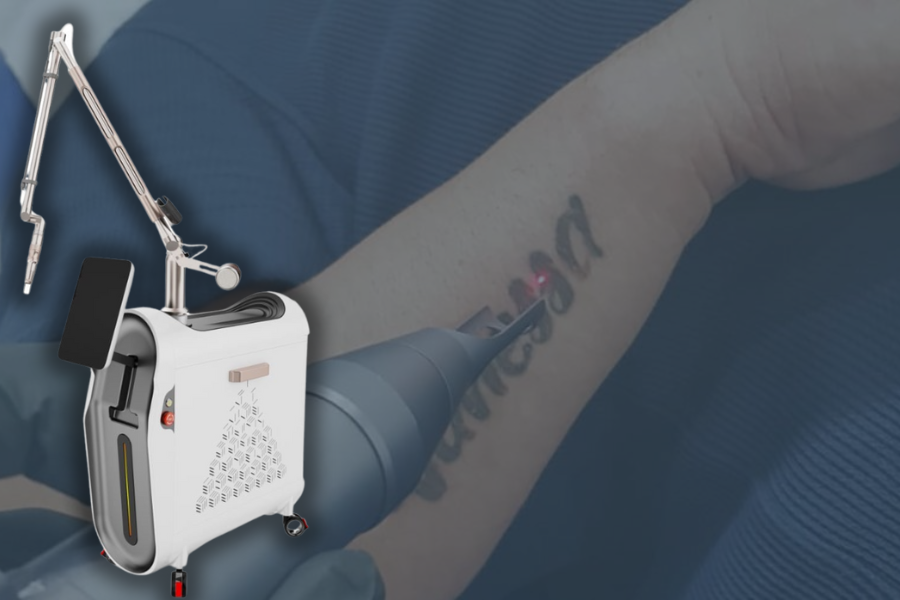 best tattoo removal laser machine