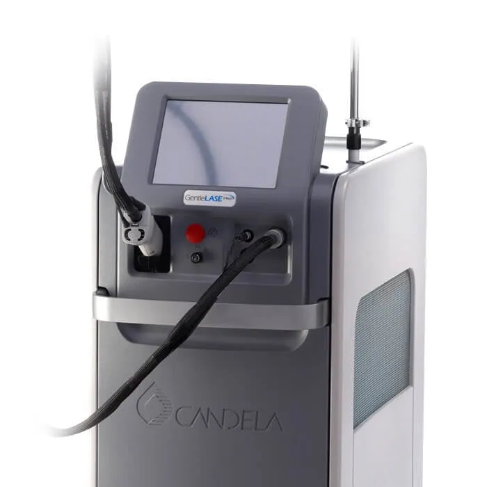 Candela hair removal