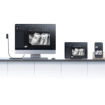 Woodpacker intra oral sensor size 2 i-sensore H2 - Image 5