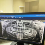 Planmeca ProMax Panoramic with  Cephalometric X-Ray Unit - Image 3