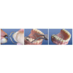 Saddle Metal Matrices – Universal Kit (36 pcs) - Image 5